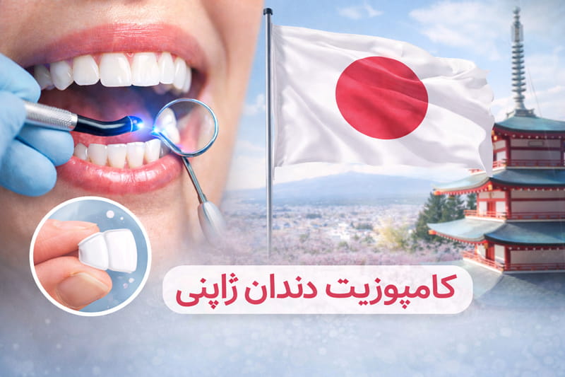 کامپوزیت ژاپنی بهتره یا المانی