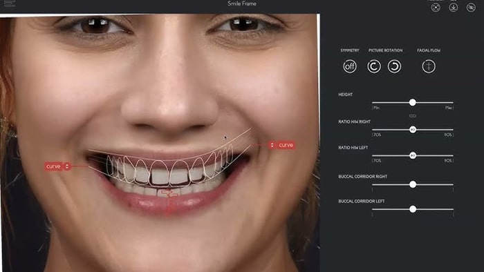 قیمت طرح لبخند
