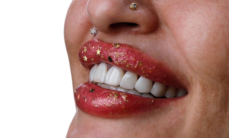 عکس کامپوزیت دندان قبل و بعد