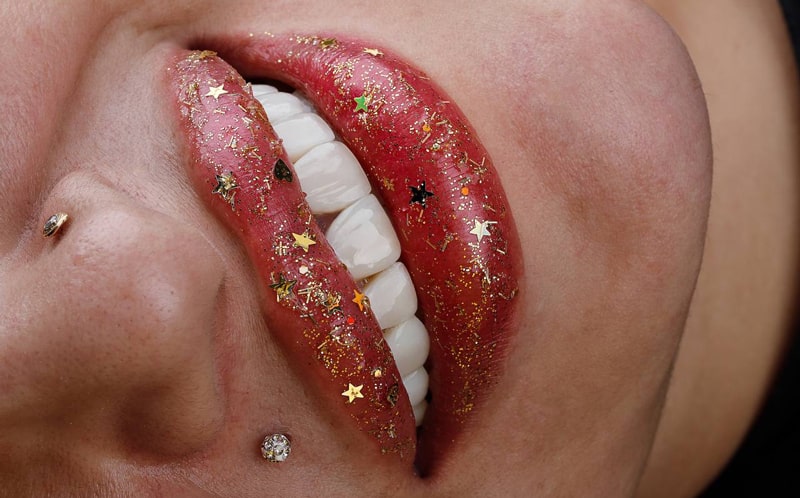 عکس کامپوزیت دندان قبل و بعد