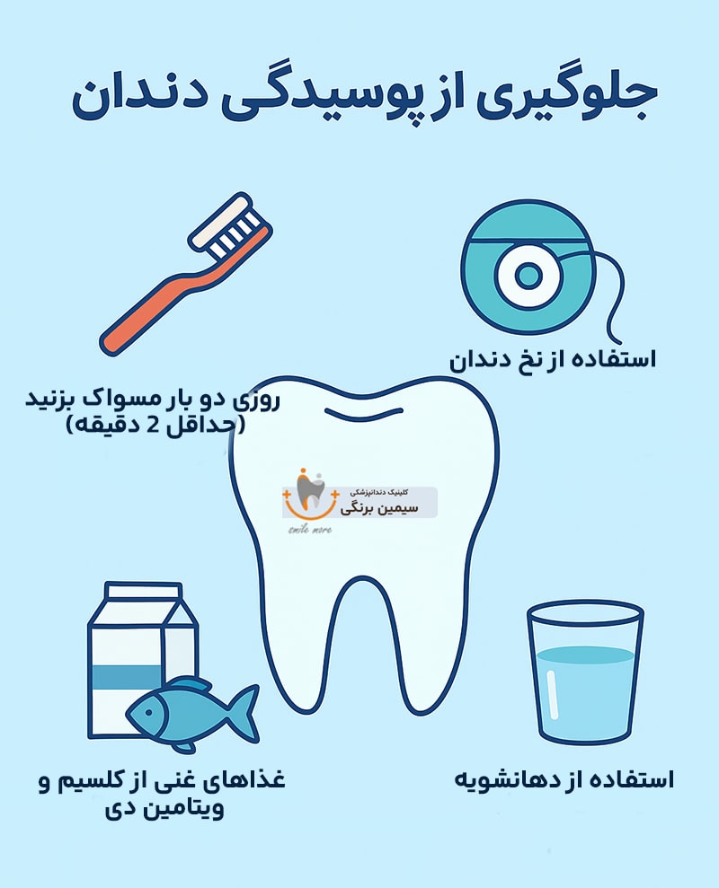 جلوگیری از پوسیدگی دندان