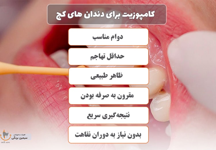 کامپوزیت برای دندان های کج