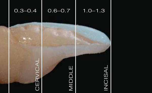 ضخامت کامپوزیت دندان