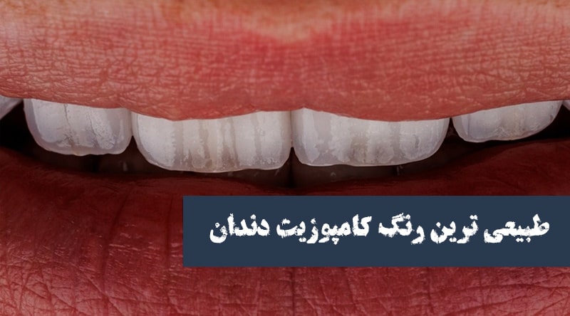 رنگ طبیعی کامپوزیت