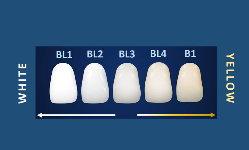 انواع رنگ کامپوزیت دندان