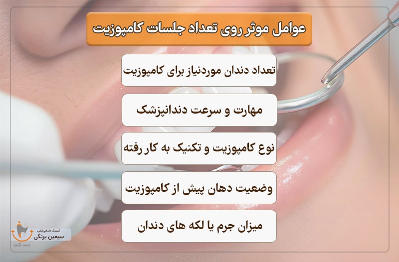 عوامل موثر در تعداد جلسات کامپوزیت چقدر طول میکشد