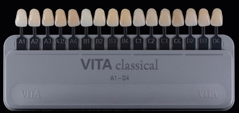 طبیعی ترین رنگ کامپوزیت