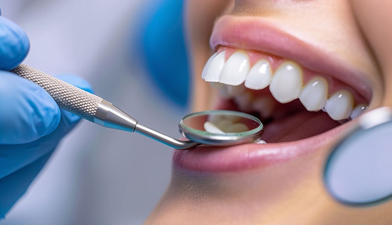 بهترین دکتر کامپوزیت در شریعتی