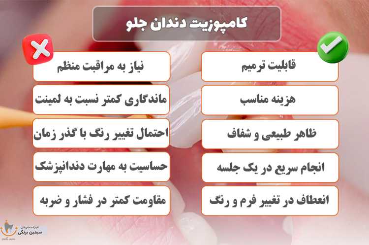 کامپوزیت دندان جلو