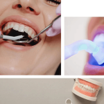 هزینه ترمیم دندان