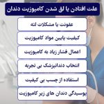 شل شدن کامپوزیت دندان