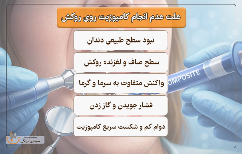 آیا دندان روکش شده را می توان کامپوزیت کرد