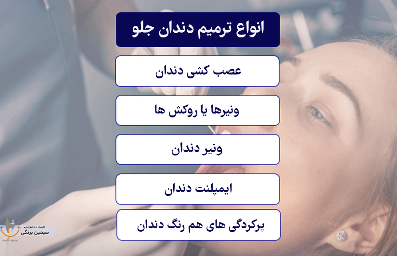 انواع ترمیم دندان های جلو