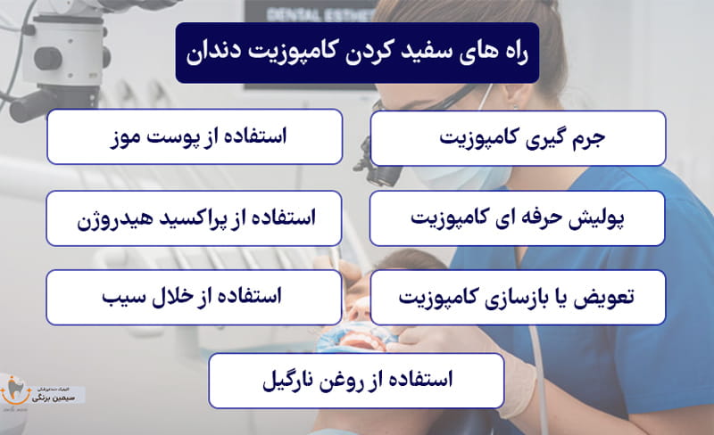 راه های سفید کردن کامپوزیت دندان