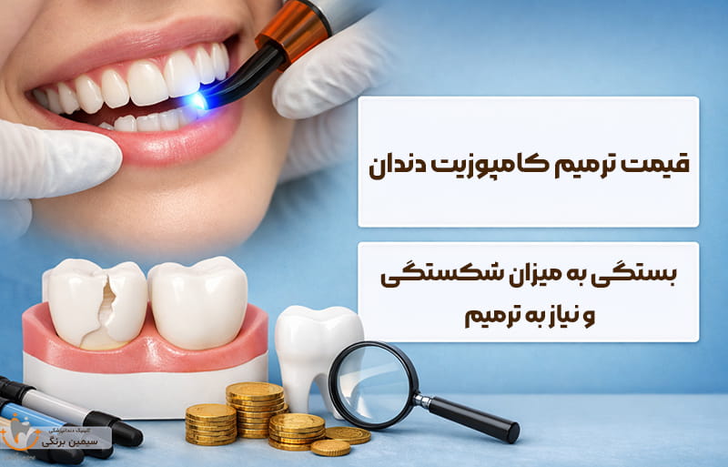 قیمت ترمیم کامپوزیت دندان