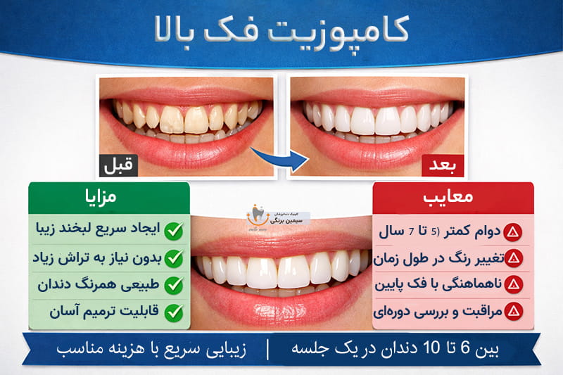 کامپوزیت فک بالا