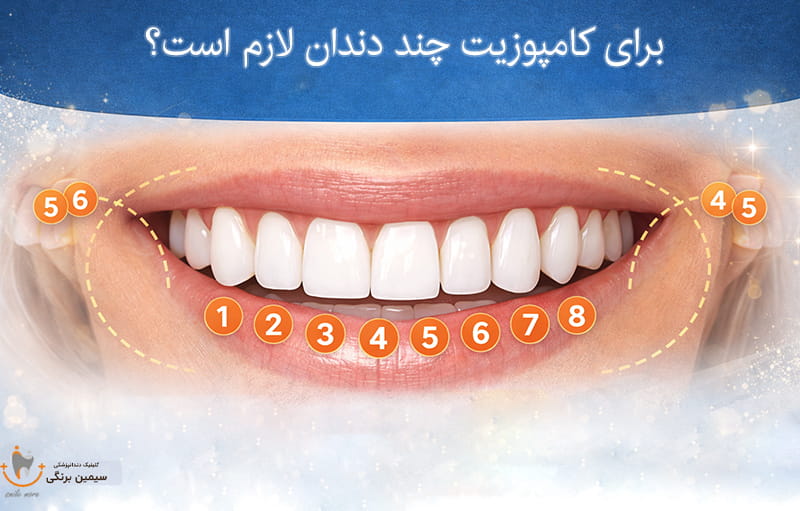 برای کامپوزیت چندتا دندان باید کار شود