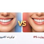 کامپوزیت ای پی اس بهتره یا توکویاما