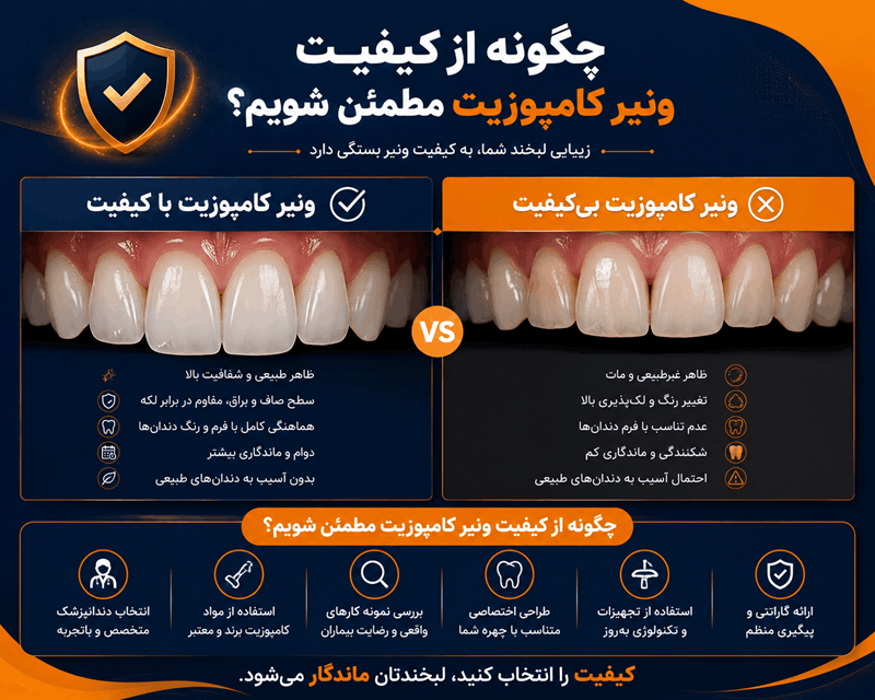 چگونه از کیفیت و رنگ کامپوزیت مطمئن شویم