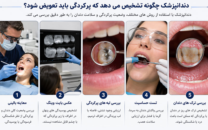 راه های تشخیص تعویض پرکردگی دندان